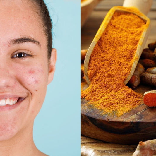 KIT JABON DE CURCUMA